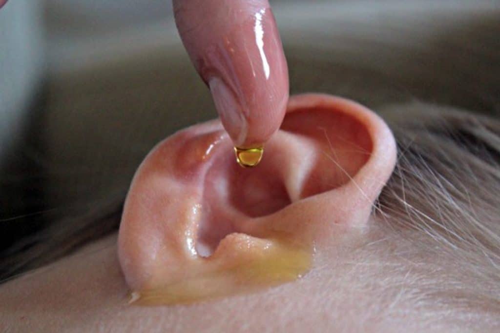 Comment déboucher une oreille ? Medica — free download